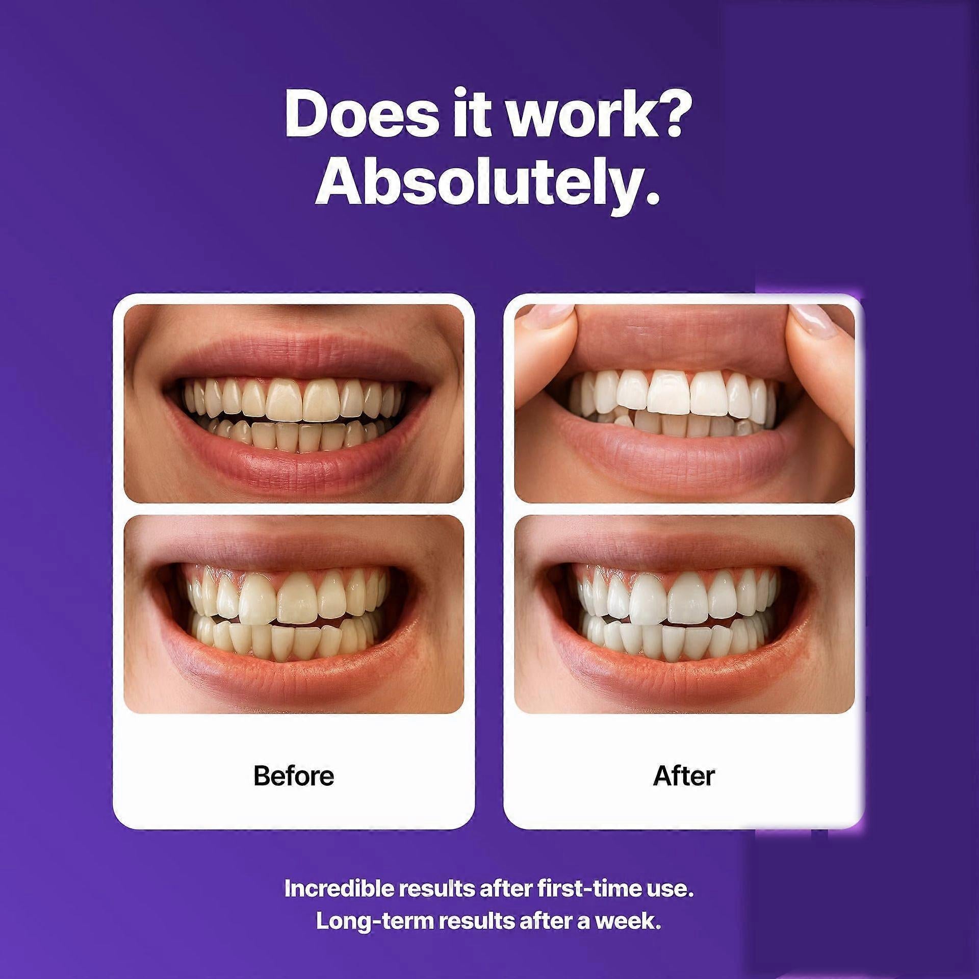 Purple Teeth Whitening Strips | Color-Correcting PAP+ Stain Removal