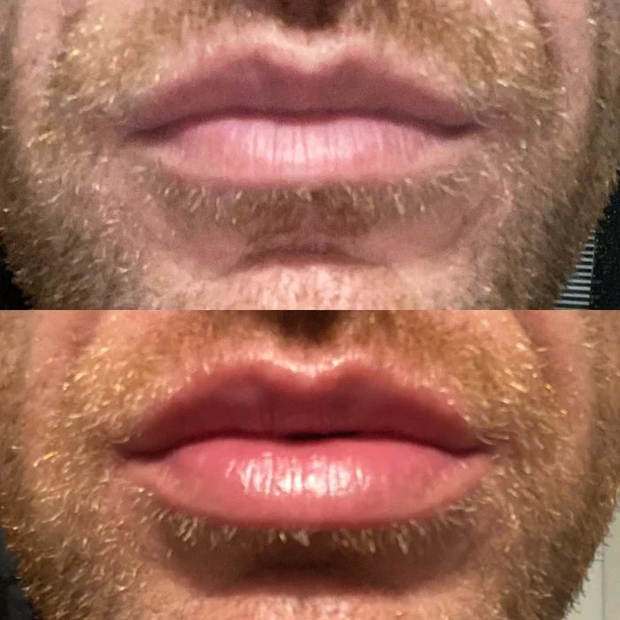 Instant Lip Plumper Serum | Hydrating Lip Filler Gloss for Volume
