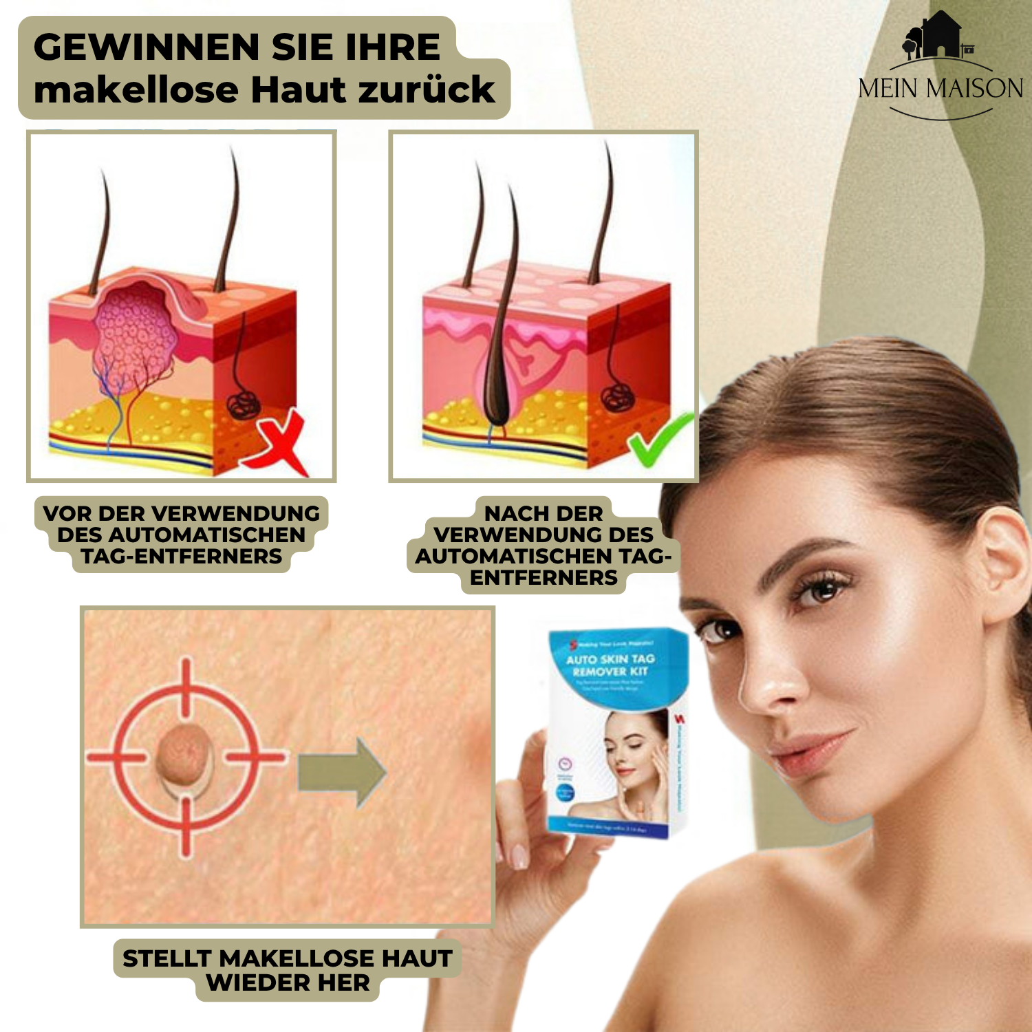 Painless Wart and Mole Remover | Effective Home Skin Tag Removal Treatment