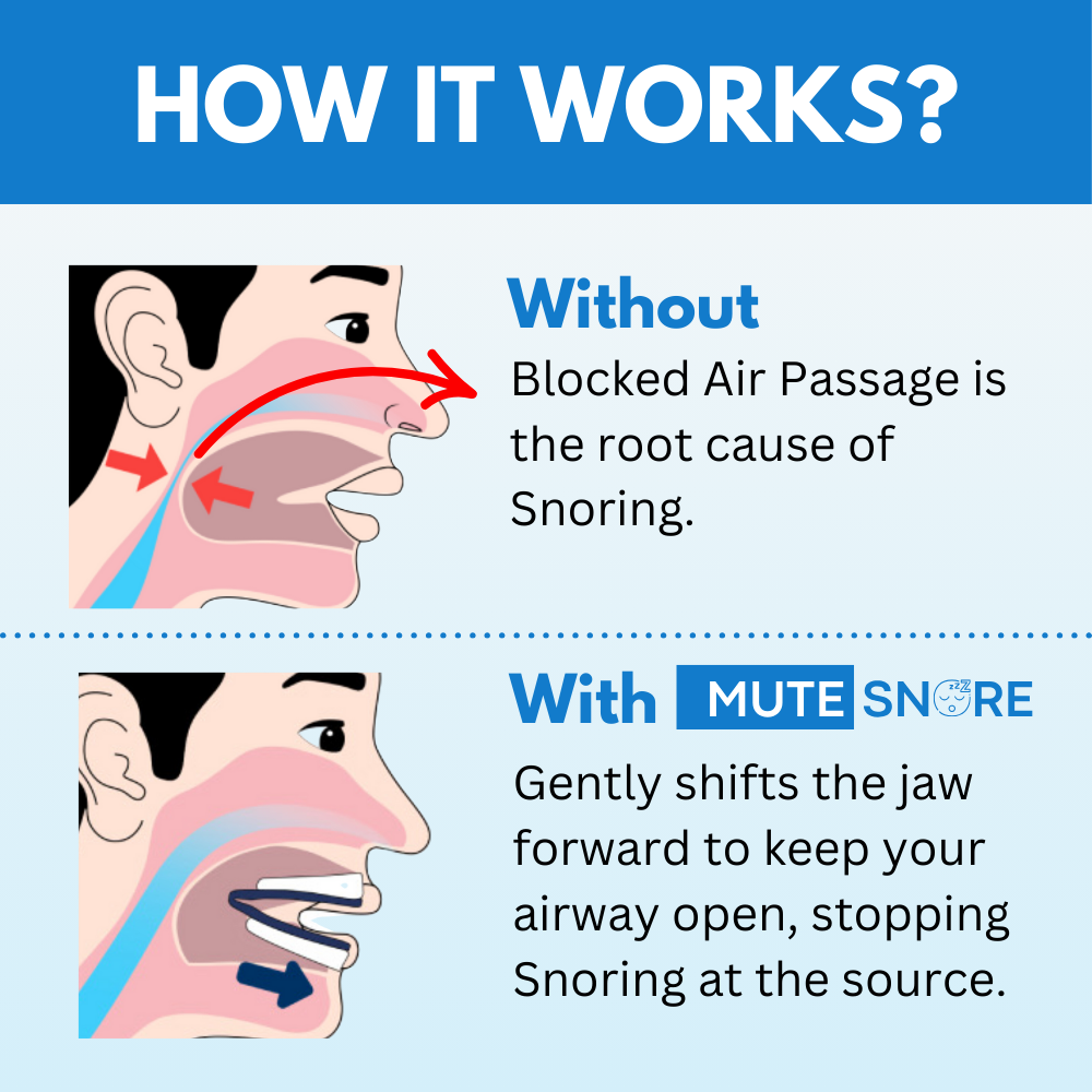 Adjustable Anti-Snoring Mouthpiece for Quiet, Restful Sleep