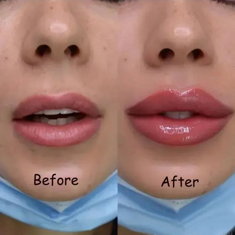 Instant Lip Plumper Serum | Hydrating Lip Filler Gloss for Volume
