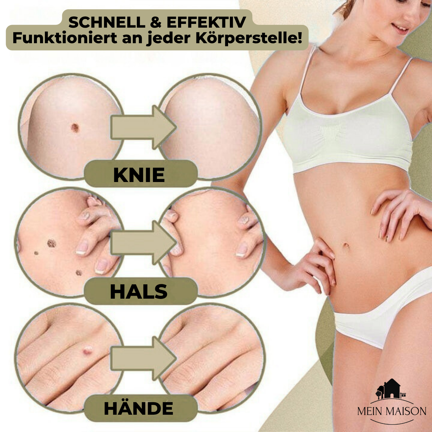 Painless Wart and Mole Remover | Effective Home Skin Tag Removal Treatment