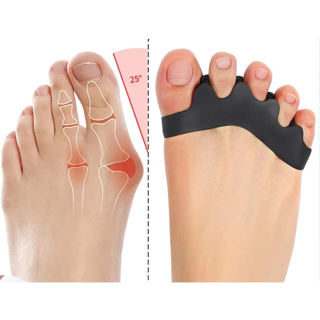 Orthopedic Toe Spacers | Bunion Corrector & Overlapping Toe Alignment