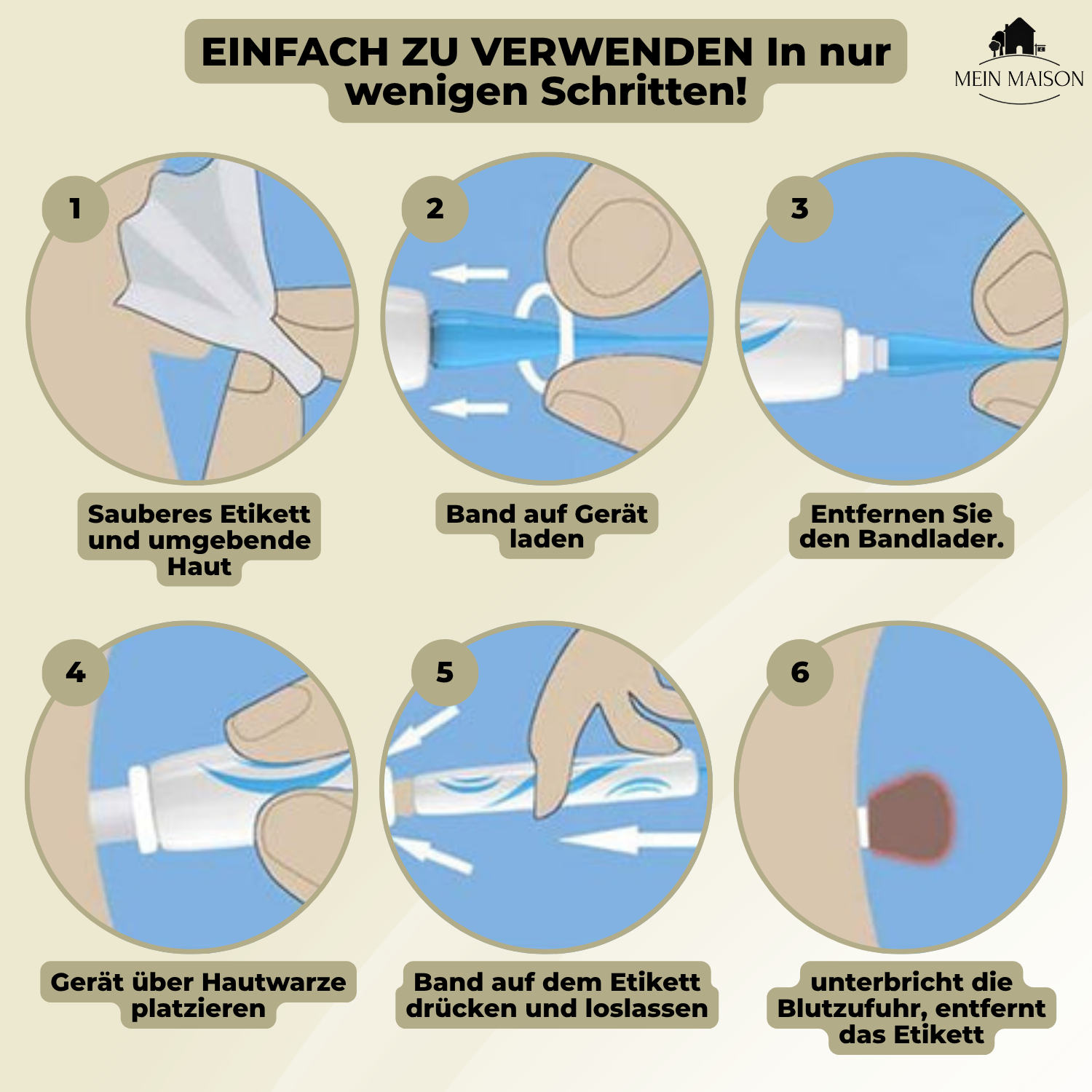 Painless Wart and Mole Remover | Effective Home Skin Tag Removal Treatment