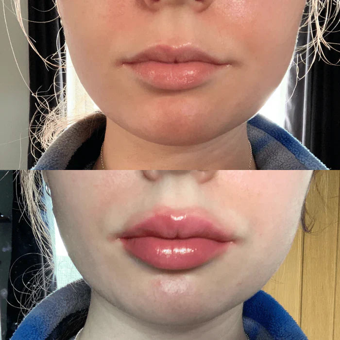 Instant Lip Plumper Serum | Hydrating Lip Filler Gloss for Volume