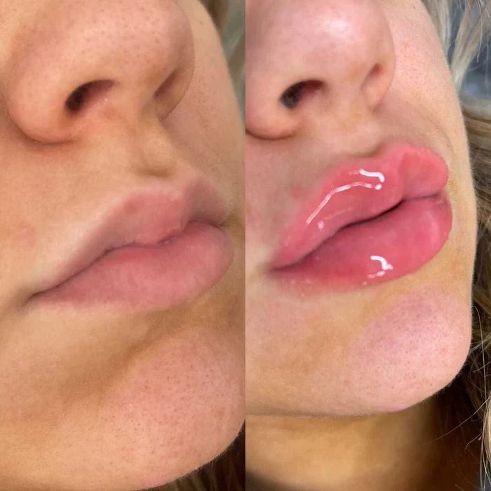 Instant Lip Plumper Serum | Hydrating Lip Filler Gloss for Volume