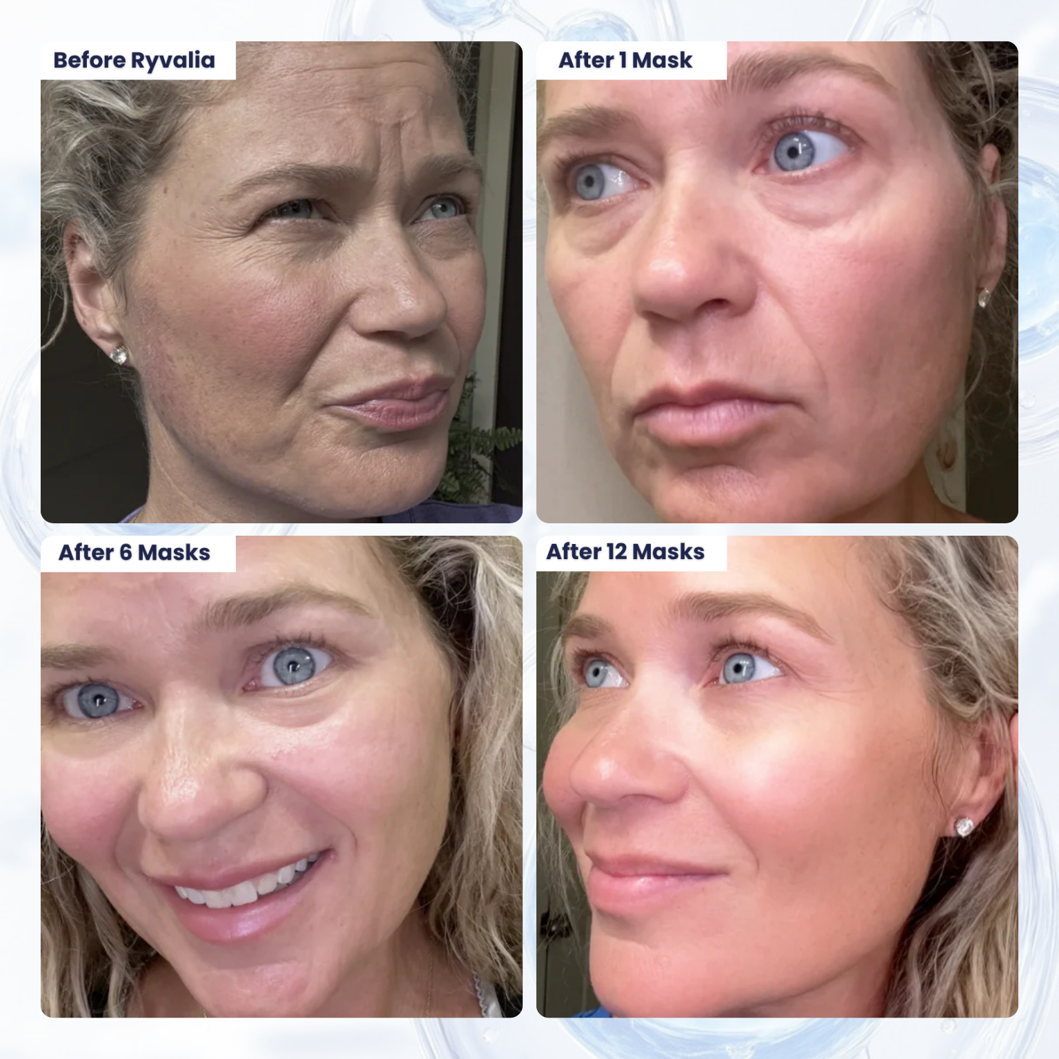 Bio-Collagen Hydrating Face Mask | Anti-Aging Firming & Moisture Mask