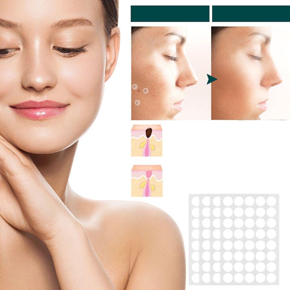 Discreet Skin Clearing Patch for the Removal of Spots and Warts