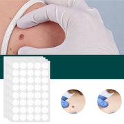 Discreet Skin Clearing Patch for the Removal of Spots and Warts