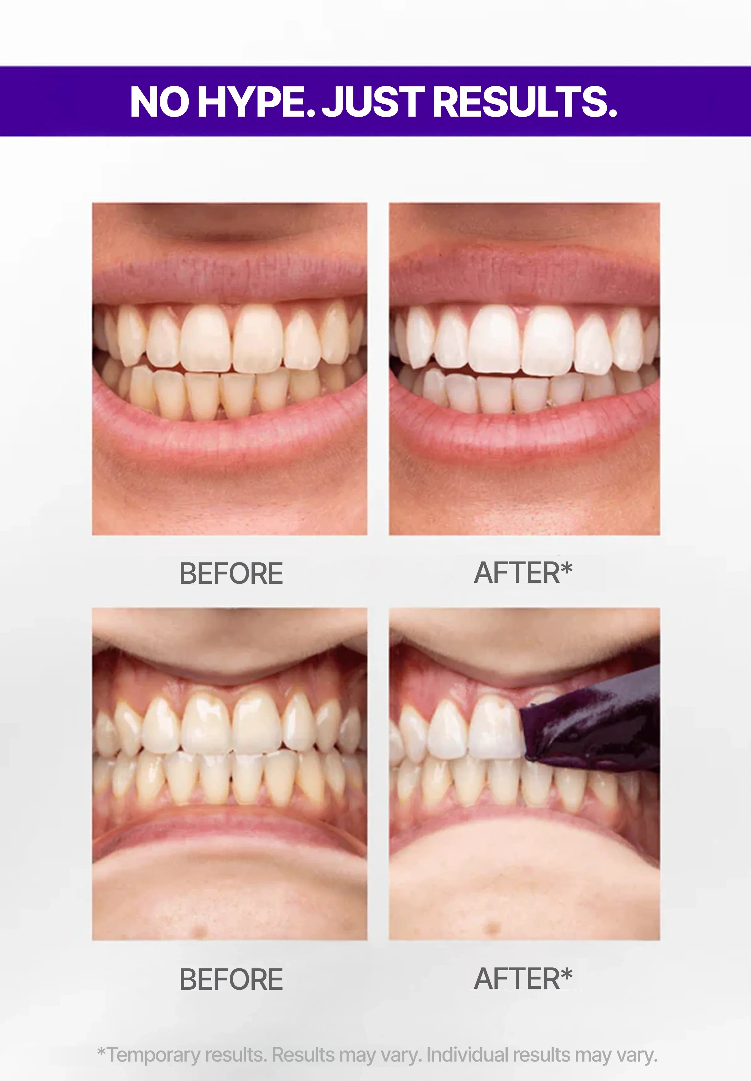 Purple Teeth Whitening Strips | Color-Correcting PAP+ Stain Removal