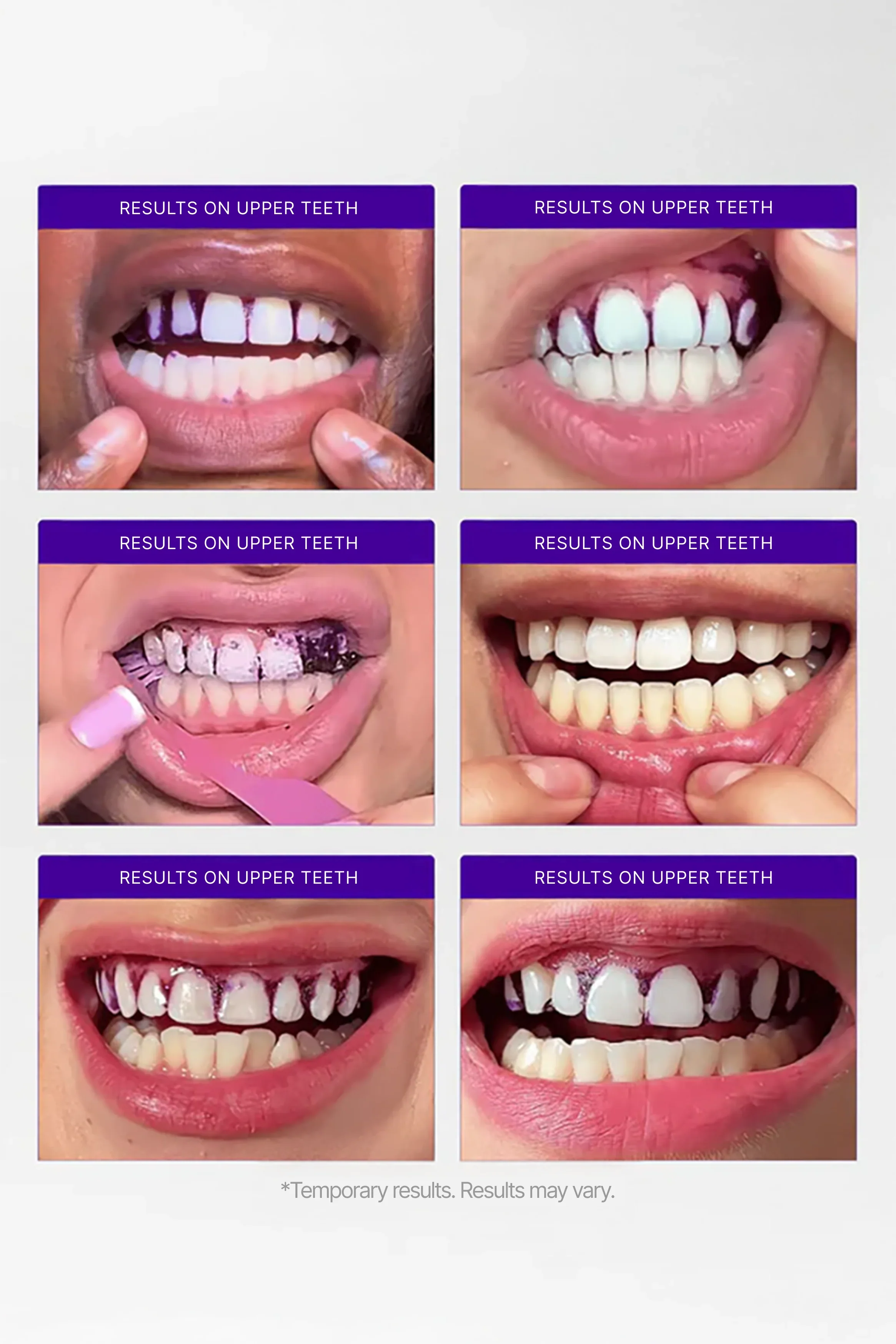 Purple Teeth Whitening Strips | Color-Correcting PAP+ Stain Removal